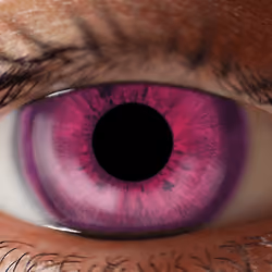 Iris eye change color