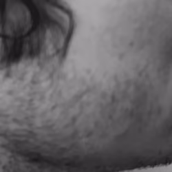 Right Cheek