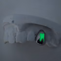 CUSTOM GLOW IN THE DARK GRILLZ #21