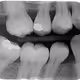 teeth test