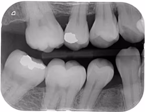 Item #21056784638844622768084528003158944460615309907067864017311112997054881726465 Media