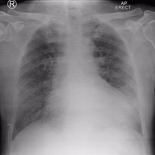 Thorax