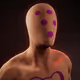 471