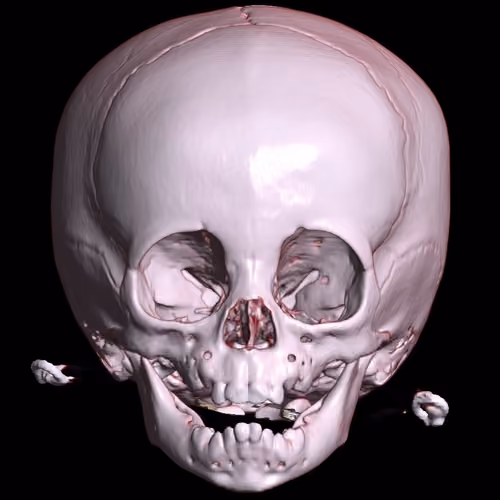 Head Injury Patients