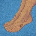 Meet the stolen feet!