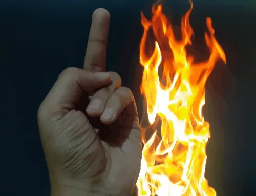 bad hand