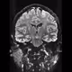 The-brain-collection