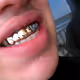 GIANTPIFF