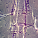 Diaxonal