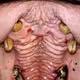 Guttoral