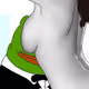 chronic_degen