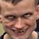 vsmeth