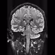 The_brain_collection