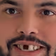 cbhoyo