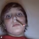 MikeyBurnt1