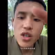XIAOd12