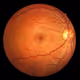 ophthalmolog