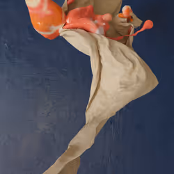 86