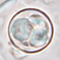 CYCLOSPORA