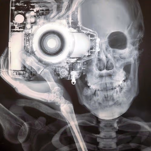 Photoskeleton