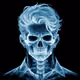 Glowing x ray