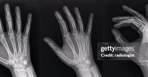 XRAY HANDS