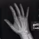 XRAY HANDS