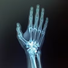X-Ray Vision