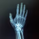 X-Ray Vision