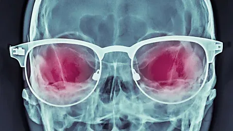 X-Ray Vision: Hidden Core
