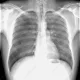 Vission X-Ray