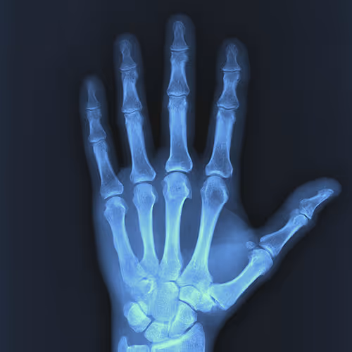 XRay Vision