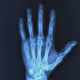 XRay Vision