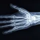 HandSom