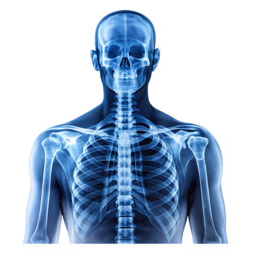 X-ray