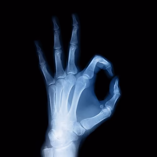 X-Ray Vision