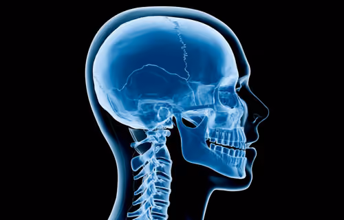 head