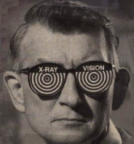 X-ray-man