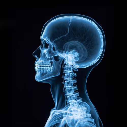 X-ray
