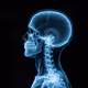 X-ray