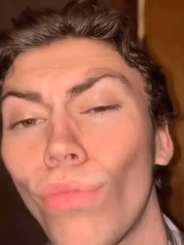 ypp