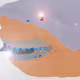 72