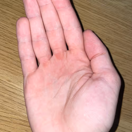Hand begging for alms