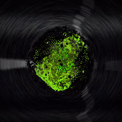 UNESTABLE PARTICLE 3