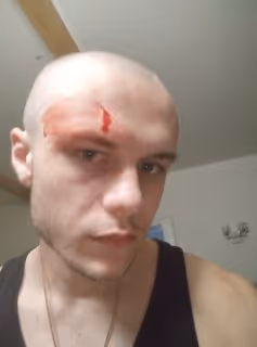 bloody man
