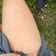 leging bolno