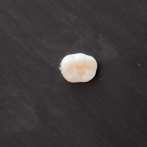 baby teeth