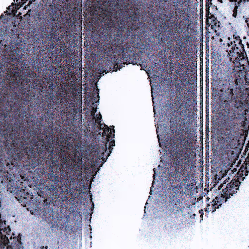ANALOG_SEIZURES