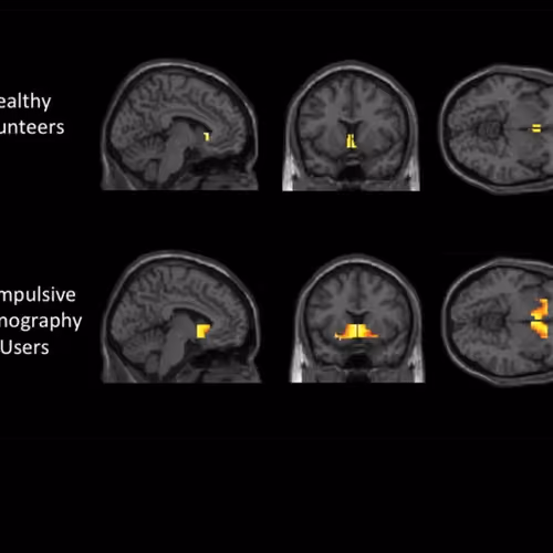 Study effect on brain