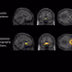 Study effect on brain